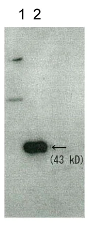 Western blot - Anti-RNQ1 antibody - C-terminal (AB188279)