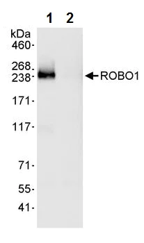 Immunoprecipitation - Anti-Robo1 antibody (AB245516)