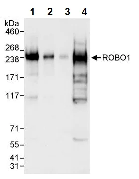 Western blot - Anti-Robo1 antibody (AB245516)