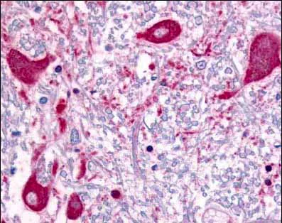 Immunohistochemistry (Formalin/PFA-fixed paraffin-embedded sections) - Anti-Robo1 antibody (AB7279)