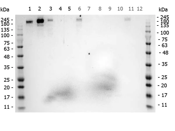 Western blot - Anti-Robo1 antibody (AB7279)