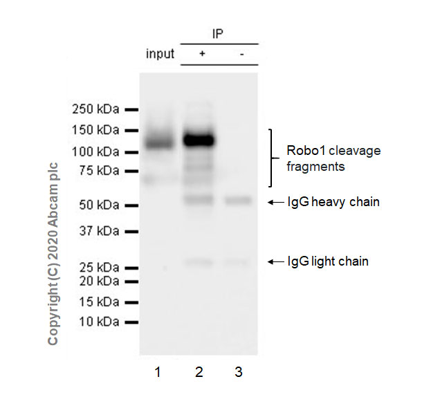Immunoprecipitation - Anti-Robo1 antibody [EPR23699-159] (AB256791), expandable thumbnail