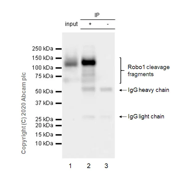 Immunoprecipitation - Anti-Robo1 antibody [EPR23699-159] (AB256791)