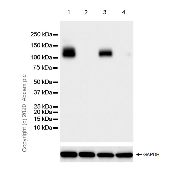 Western blot - Anti-Robo1 antibody [EPR23699-159] (ab256791), expandable thumbnail