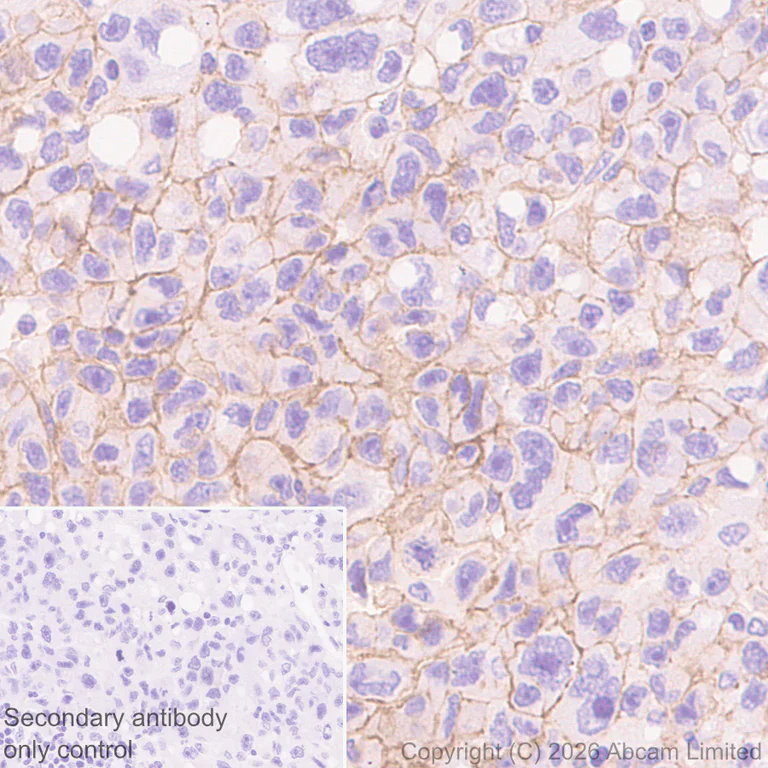 Immunohistochemistry (Formalin/PFA-fixed paraffin-embedded sections) - Anti-Robo1 antibody [EPR29534-534] (AB326048)