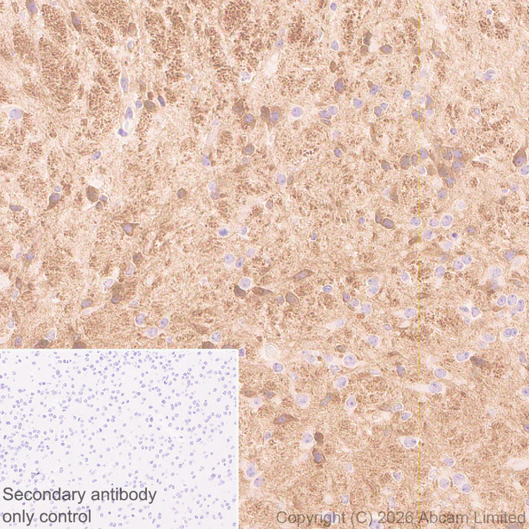 Immunohistochemistry (Formalin/PFA-fixed paraffin-embedded sections) - Anti-Robo1 antibody [EPR29534-534] (AB326048)