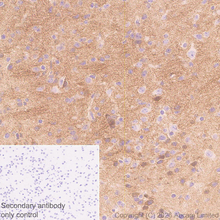 Immunohistochemistry (Formalin/PFA-fixed paraffin-embedded sections) - Anti-Robo1 antibody [EPR29534-534] (AB326048)
