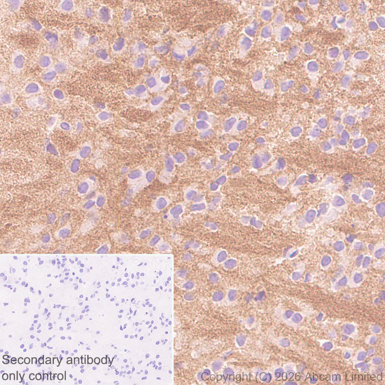 Immunohistochemistry (Formalin/PFA-fixed paraffin-embedded sections) - Anti-Robo1 antibody [EPR29534-534] (AB326048)