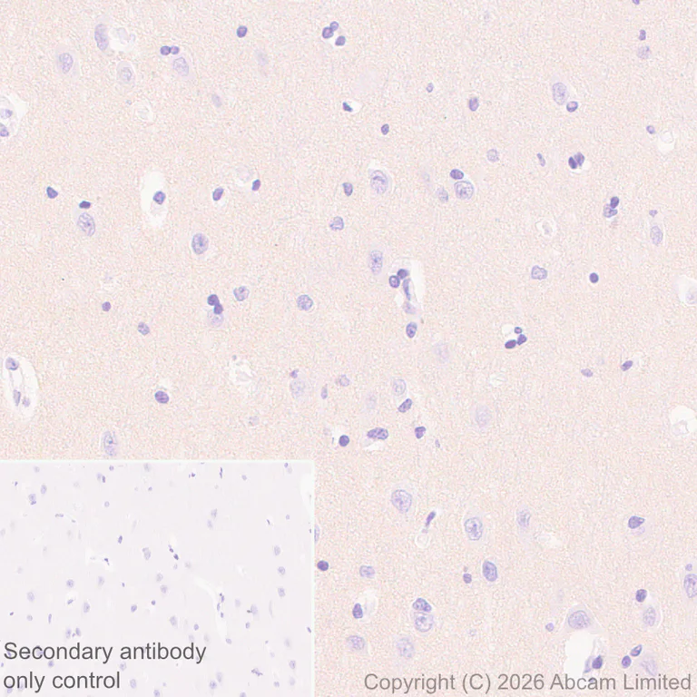 Immunohistochemistry (Formalin/PFA-fixed paraffin-embedded sections) - Anti-Robo1 antibody [EPR29534-534] (AB326048)
