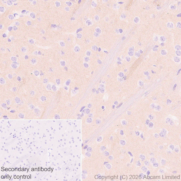 Immunohistochemistry (Formalin/PFA-fixed paraffin-embedded sections) - Anti-Robo1 antibody [EPR29534-534] (AB326048)