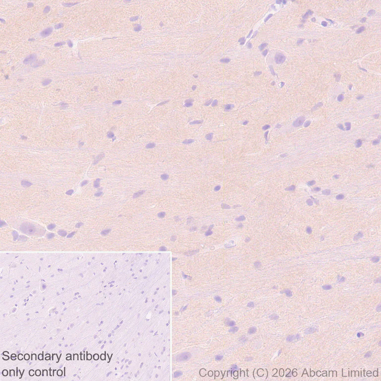 Immunohistochemistry (Formalin/PFA-fixed paraffin-embedded sections) - Anti-Robo1 antibody [EPR29534-534] (AB326048)