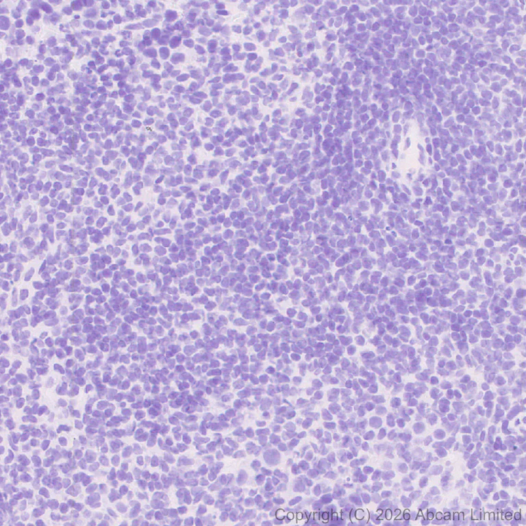 Immunohistochemistry (Formalin/PFA-fixed paraffin-embedded sections) - Anti-Robo1 antibody [EPR29534-534] (AB326048)
