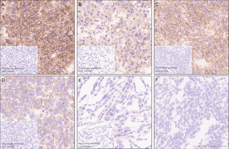 Immunohistochemistry (Formalin/PFA-fixed paraffin-embedded sections) - Anti-Robo1 antibody [EPR29534-534] (AB326048)