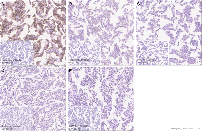 Immunohistochemistry (Formalin/PFA-fixed paraffin-embedded sections) - Anti-Robo1 antibody [EPR29534-534] (AB326048)