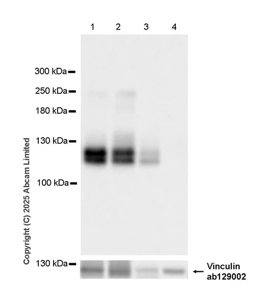 Western blot - Anti-Robo1 antibody [EPR29534-534] (AB326048)