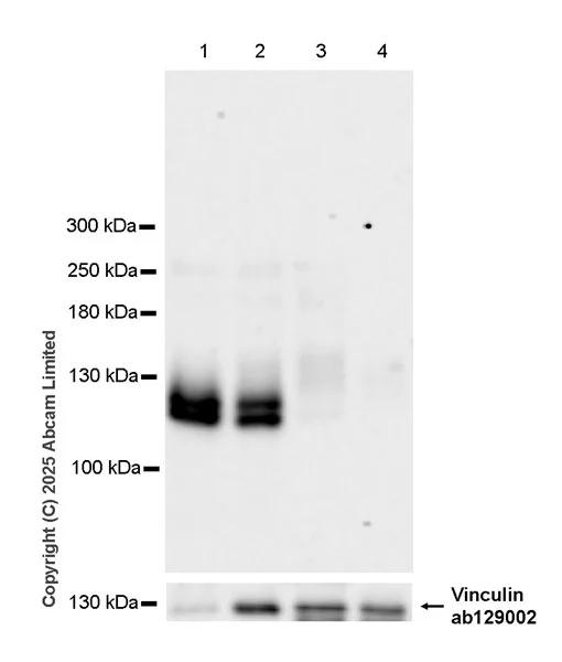 Western blot - Anti-Robo1 antibody [EPR29534-534] (AB326048)