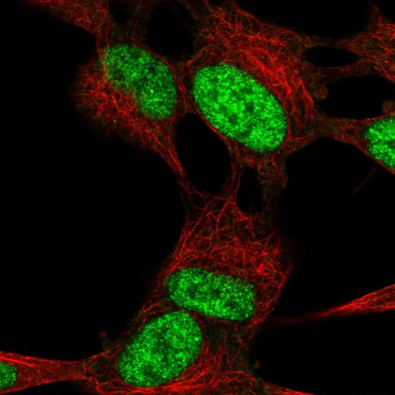 Immunocytochemistry/ Immunofluorescence - Anti-Robo2 antibody (AB244331), expandable thumbnail