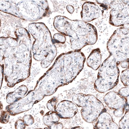 Immunohistochemistry (Formalin/PFA-fixed paraffin-embedded sections) - Anti-Robo2 antibody (AB244331), expandable thumbnail