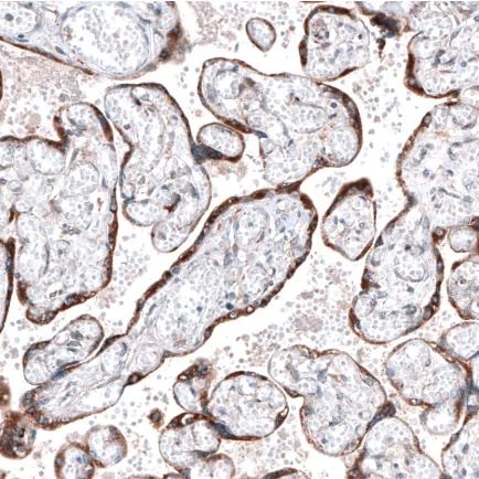 Immunohistochemistry (Formalin/PFA-fixed paraffin-embedded sections) - Anti-Robo2 antibody (AB244331)