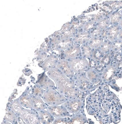 Immunohistochemistry (Formalin/PFA-fixed paraffin-embedded sections) - Anti-Robo2 antibody (ab244331), expandable thumbnail