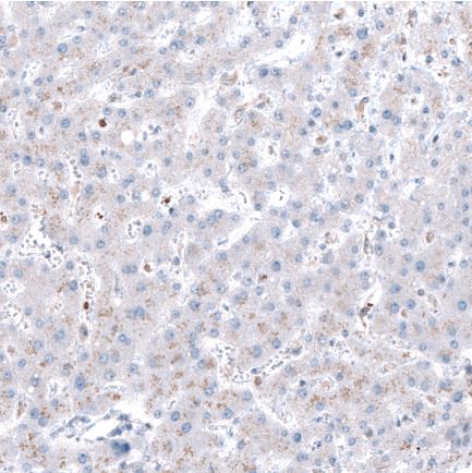 Immunohistochemistry (Formalin/PFA-fixed paraffin-embedded sections) - Anti-Robo2 antibody (AB244331), expandable thumbnail