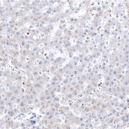 Immunohistochemistry (Formalin/PFA-fixed paraffin-embedded sections) - Anti-Robo2 antibody (AB244331)