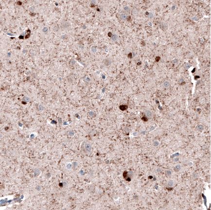 Immunohistochemistry (Formalin/PFA-fixed paraffin-embedded sections) - Anti-Robo2 antibody (AB244331), expandable thumbnail