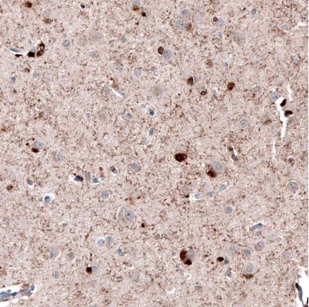 Immunohistochemistry (Formalin/PFA-fixed paraffin-embedded sections) - Anti-Robo2 antibody (AB244331)