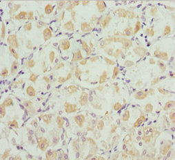 Immunohistochemistry (Formalin/PFA-fixed paraffin-embedded sections) - Anti-Robo3 antibody (AB229722)