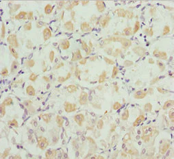 Immunohistochemistry (Formalin/PFA-fixed paraffin-embedded sections) - Anti-Robo3 antibody (AB229722)