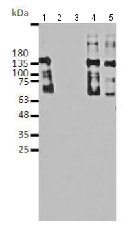 Western blot - Anti-Robo4 antibody (AB180824)