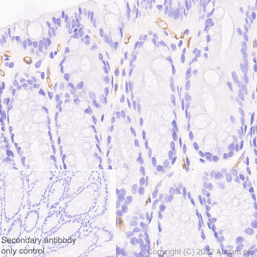 Immunohistochemistry (Formalin/PFA-fixed paraffin-embedded sections) - Anti-Robo4 antibody [EPR26282-3] (BSA and Azide free) (AB300047), expandable thumbnail