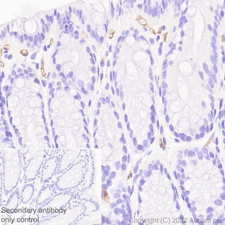 Immunohistochemistry (Formalin/PFA-fixed paraffin-embedded sections) - Anti-Robo4 antibody [EPR26282-3] (BSA and Azide free) (AB300047)