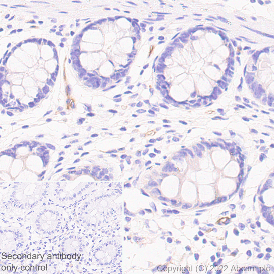 Immunohistochemistry (Formalin/PFA-fixed paraffin-embedded sections) - Anti-Robo4 antibody [EPR26282-3] (BSA and Azide free) (AB300047), expandable thumbnail