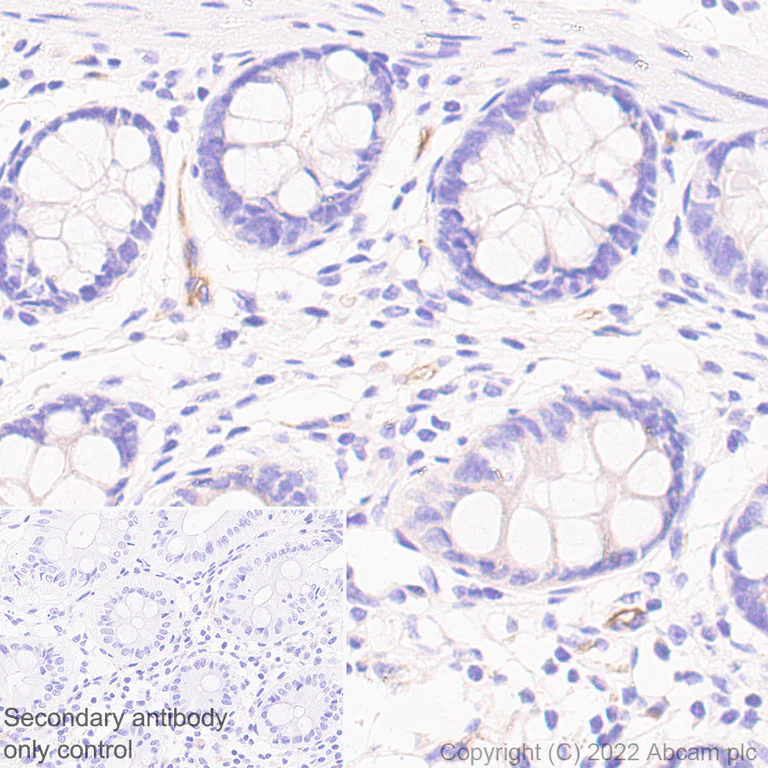 Immunohistochemistry (Formalin/PFA-fixed paraffin-embedded sections) - Anti-Robo4 antibody [EPR26282-3] (BSA and Azide free) (AB300047)