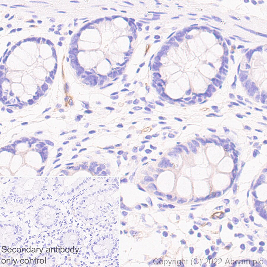 Immunohistochemistry (Formalin/PFA-fixed paraffin-embedded sections) - Anti-Robo4 antibody [EPR26282-3] (BSA and Azide free) (ab300047), expandable thumbnail