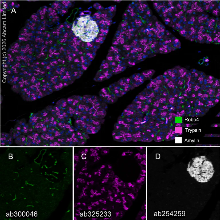 Multiplex immunohistochemistry - Anti-Robo4 antibody [EPR26282-3] (BSA and Azide free) (AB300047)