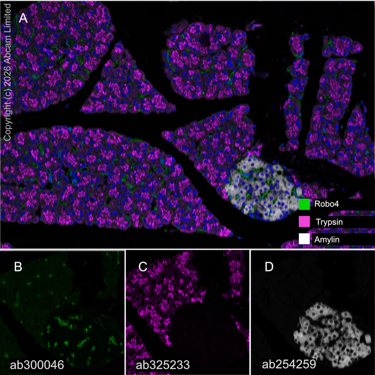 Multiplex immunohistochemistry - Anti-Robo4 antibody [EPR26282-3] (BSA and Azide free) (AB300047)