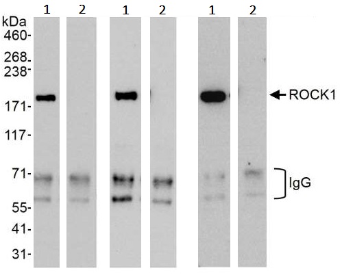 Immunoprecipitation - Anti-ROCK1 antibody (AB245368)