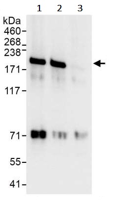 Immunoprecipitation - Anti-ROCK1 antibody (AB245369)