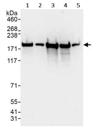 Western blot - Anti-ROCK1 antibody (AB245369)