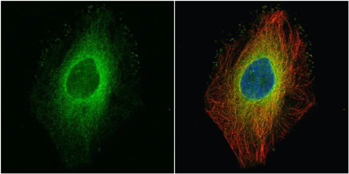 Immunocytochemistry/ Immunofluorescence - Anti-ROCK1 antibody (AB97592)