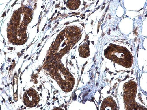 Immunohistochemistry (Formalin/PFA-fixed paraffin-embedded sections) - Anti-ROCK1 antibody (AB97592)