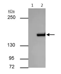 Immunoprecipitation - Anti-ROCK1 antibody (AB97592)