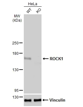 Western blot - Anti-ROCK1 antibody (AB97592)