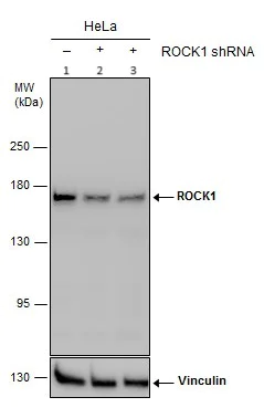 Western blot - Anti-ROCK1 antibody (AB97592)