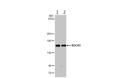 Western blot - Anti-ROCK1 antibody (AB97592)