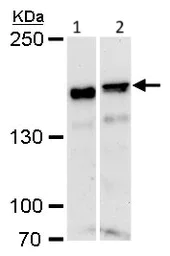 Western blot - Anti-ROCK1 antibody (AB97592)