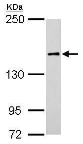 Western blot - Anti-ROCK1 antibody (AB97592)