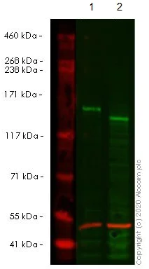 Western blot - Anti-ROCK1 antibody [EPR638Y] (AB134181)